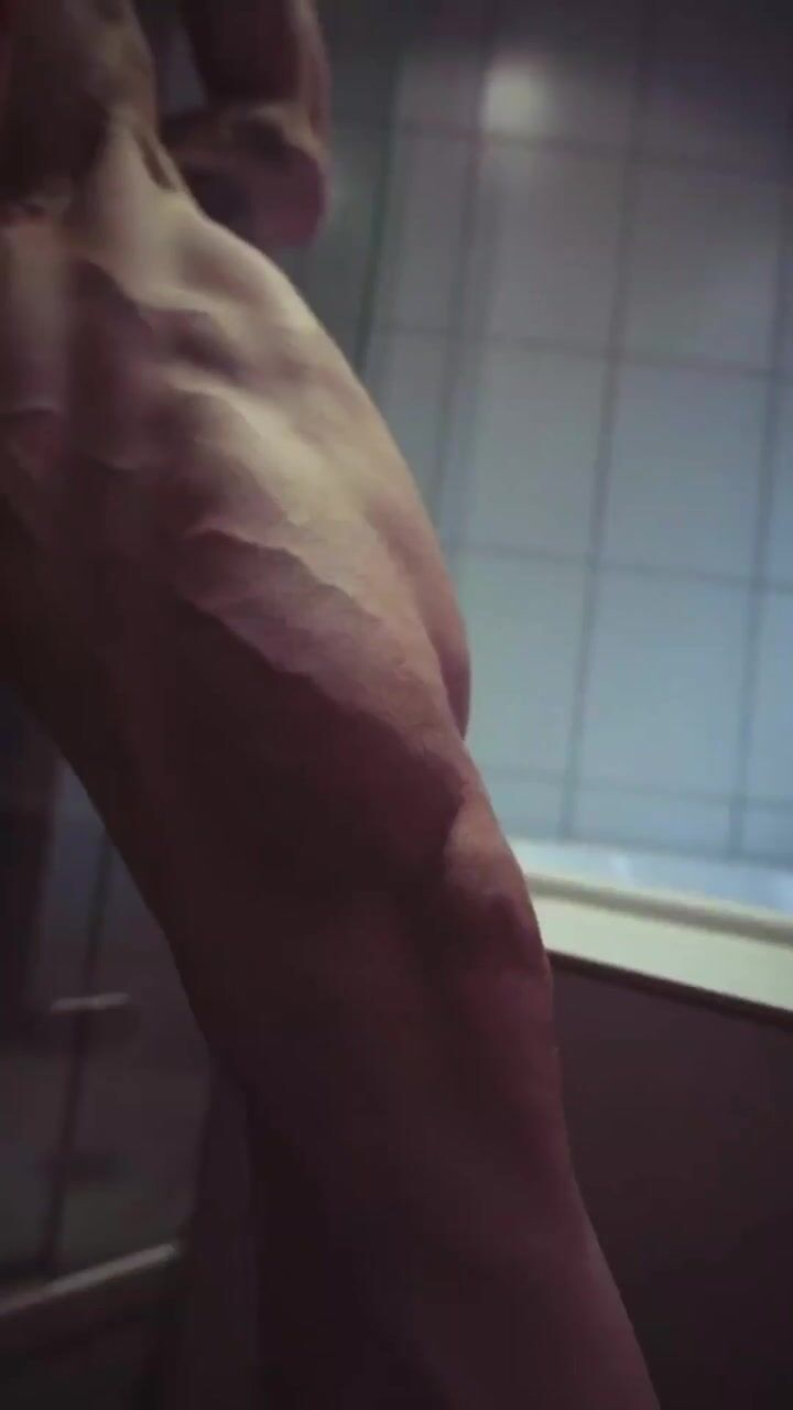 Tiffany R vascularity