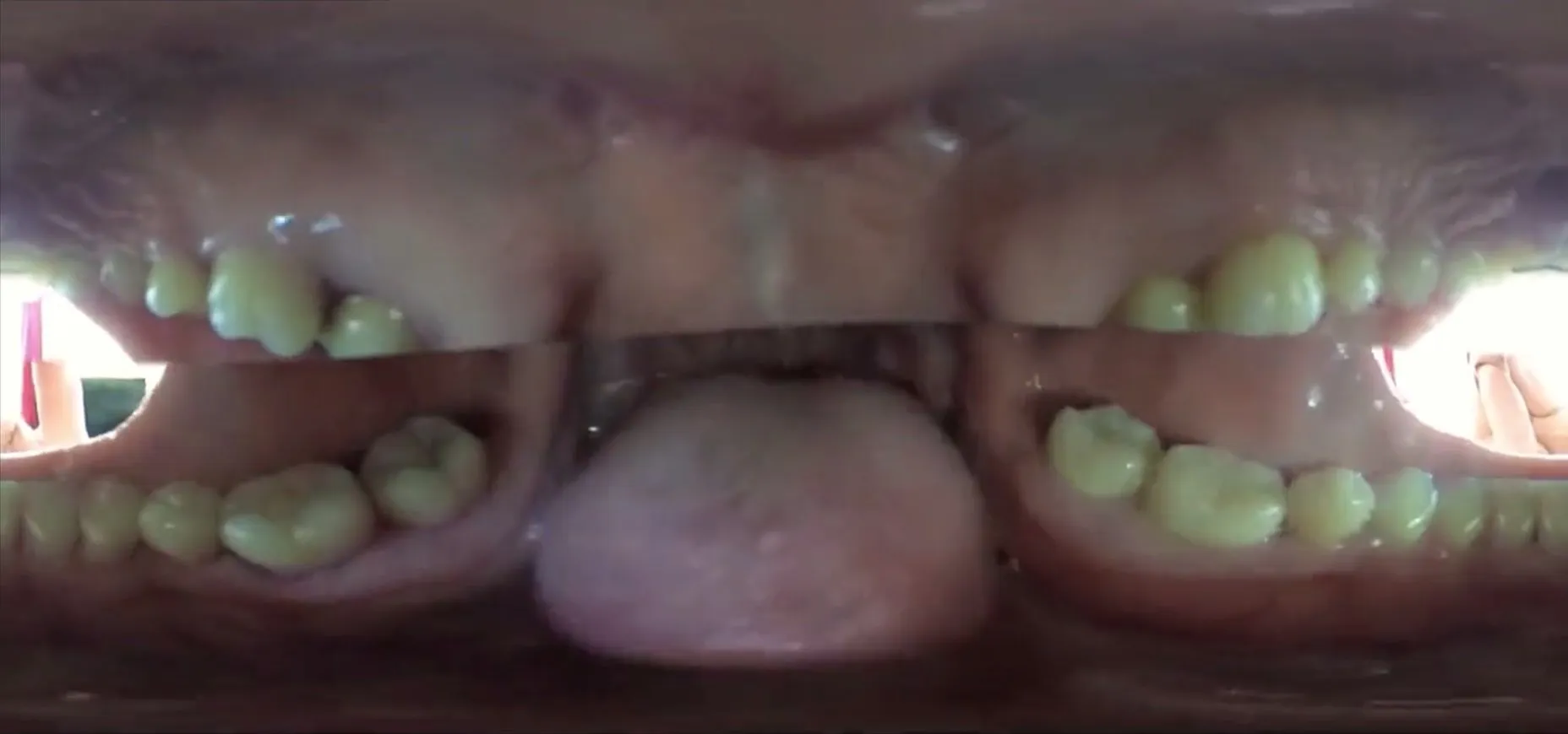 Astrodomina 360º vore (only vore part)