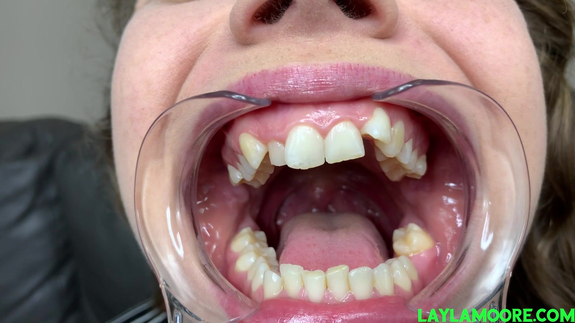 LylaMooreFetish - Luna Vera (Take a Peek At Luna's Teeth)