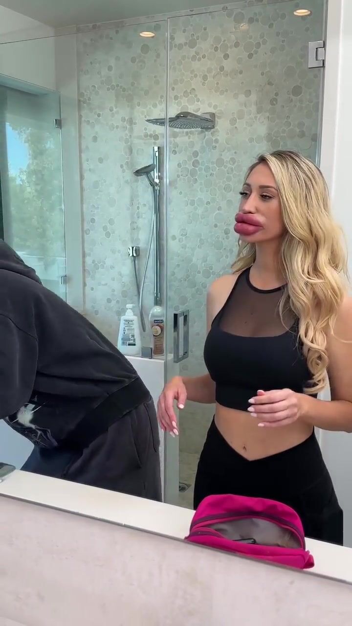 Biggest Lips