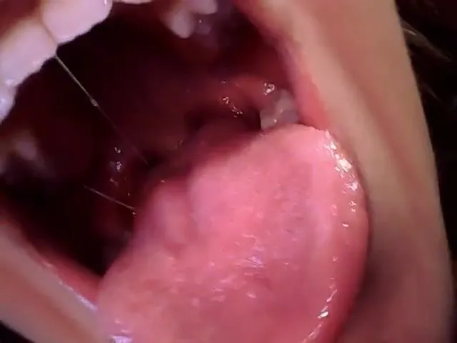 Giantess Katelyn endoscope