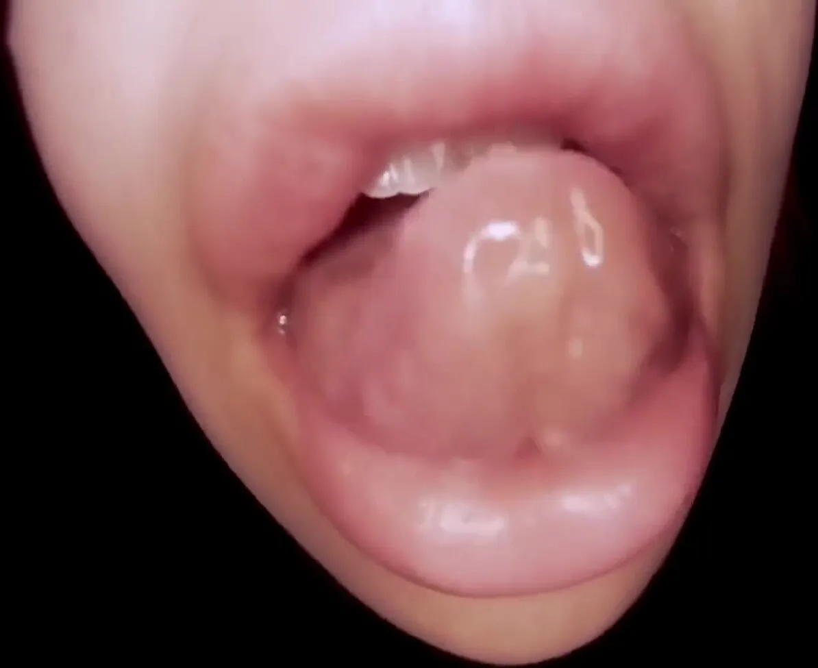Giantess Katelyn Brooks endoscopy