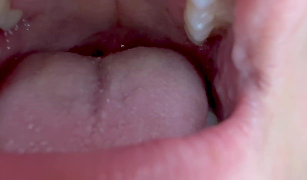 Uvula Vore