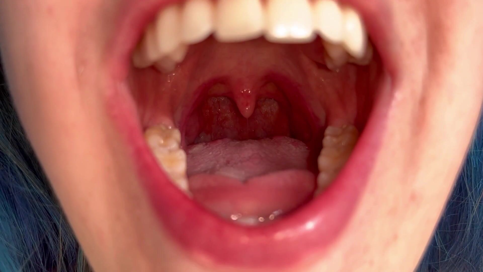 Clover Fae - Uvula Inspection - ManyVids