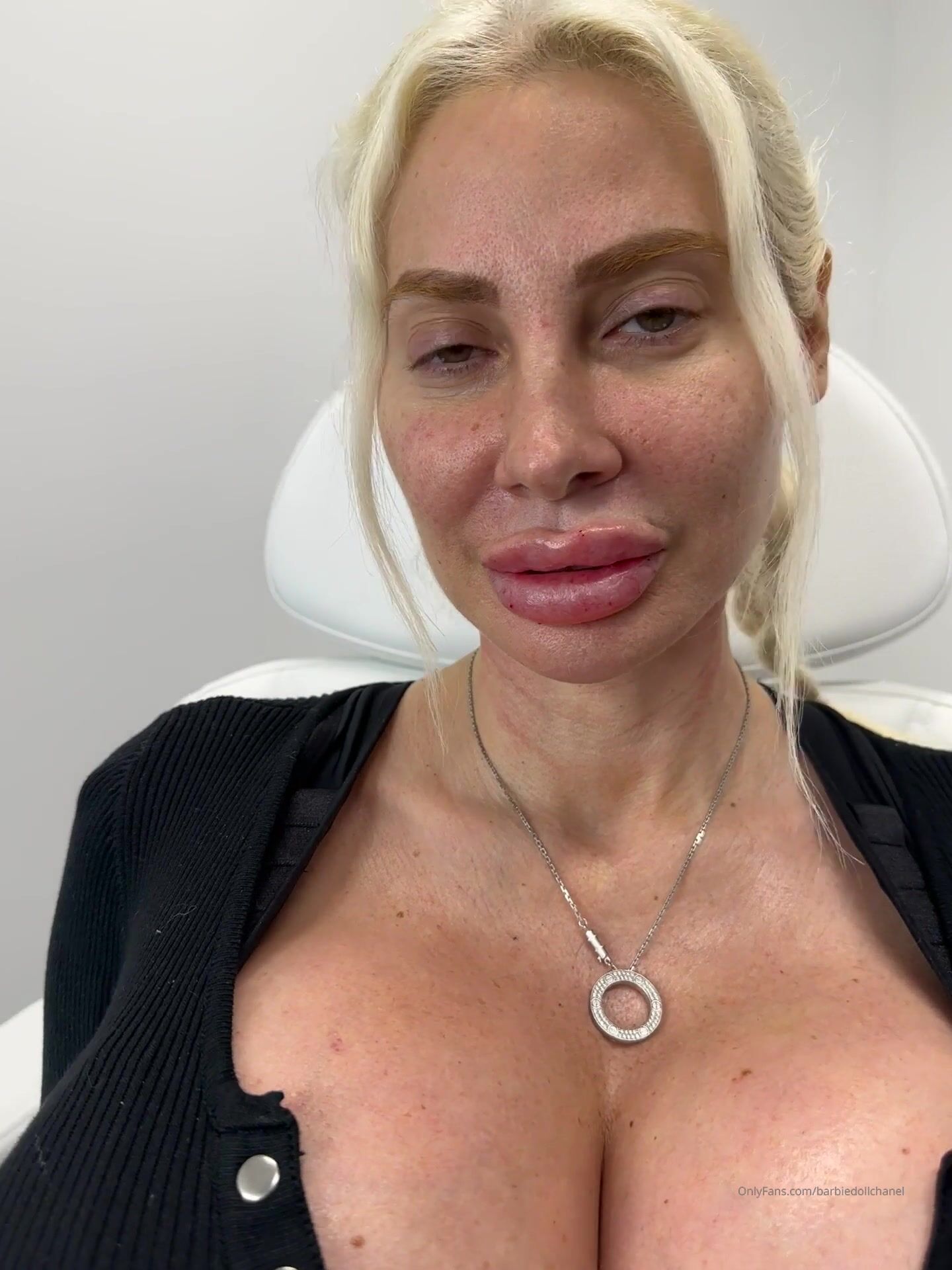 Big fake lips