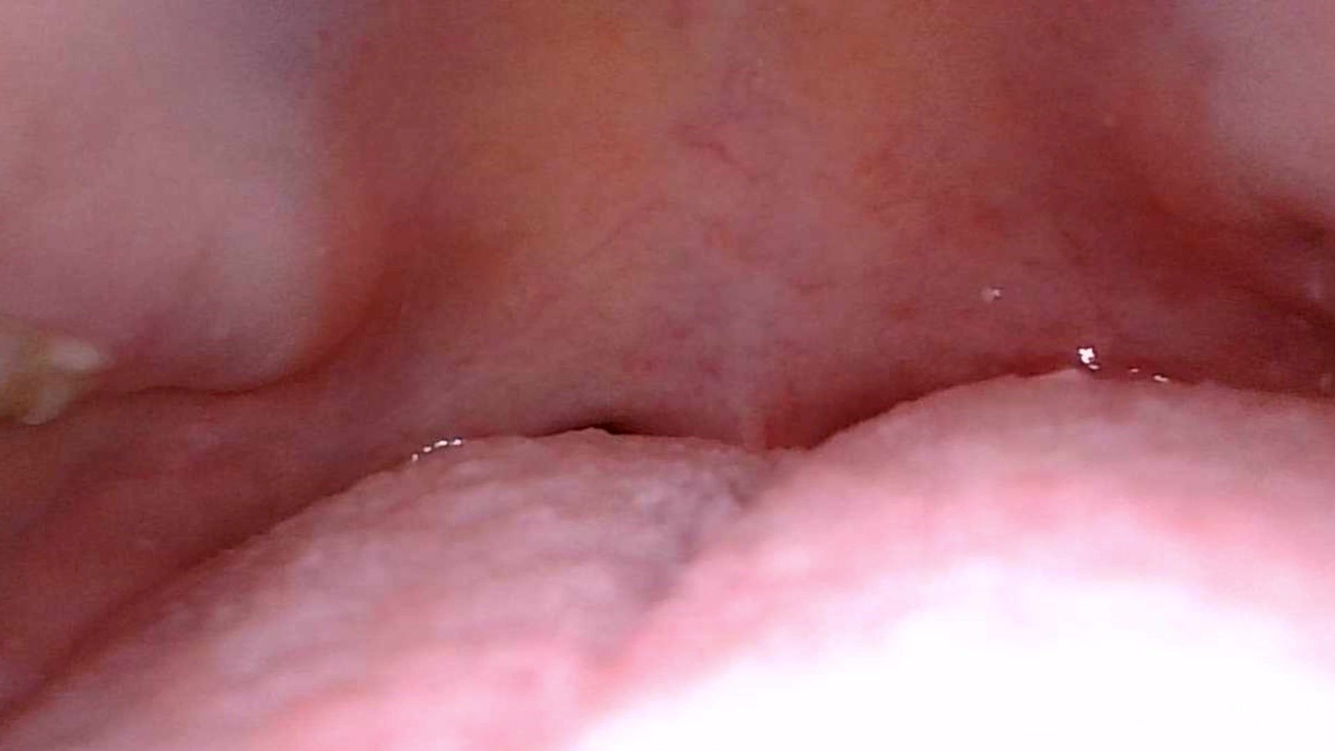 Uvula slave gets swallowed