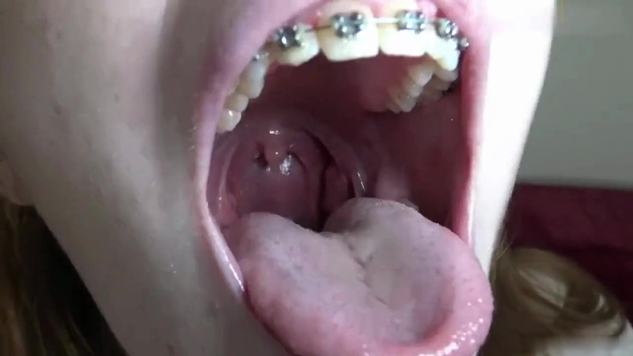 Adorable Braces Girl Swallows Gummy Worms Vore - Becky