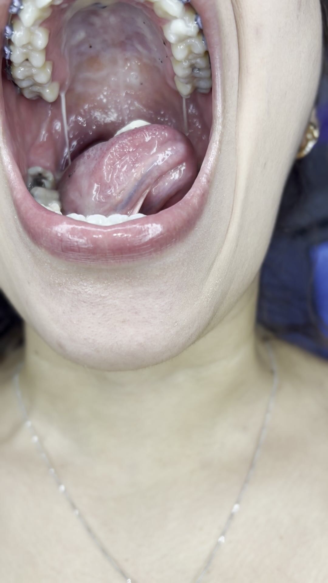kimuvula custom vore video