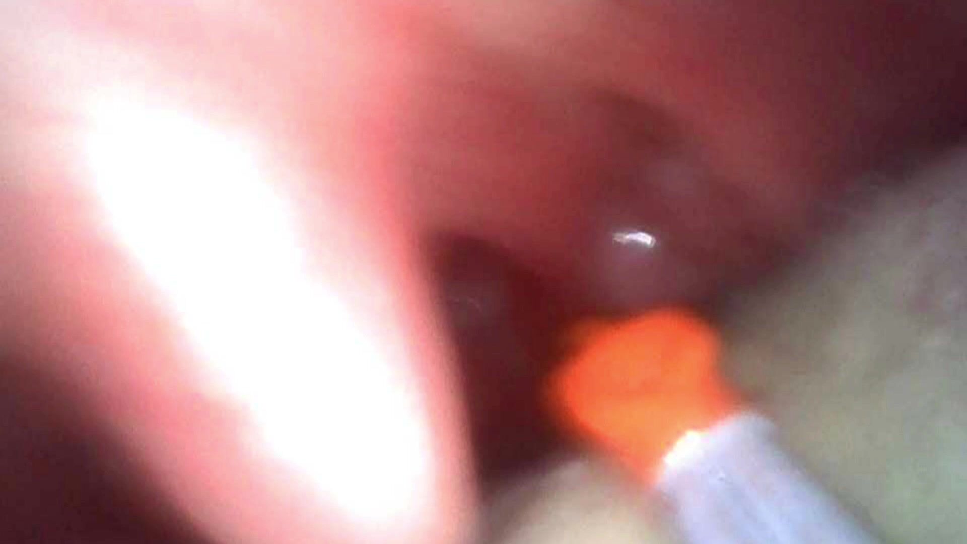 Party guest vore