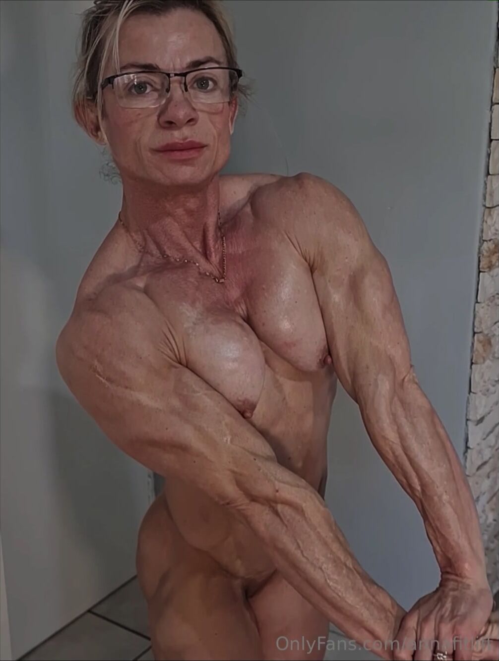 Annafitlift