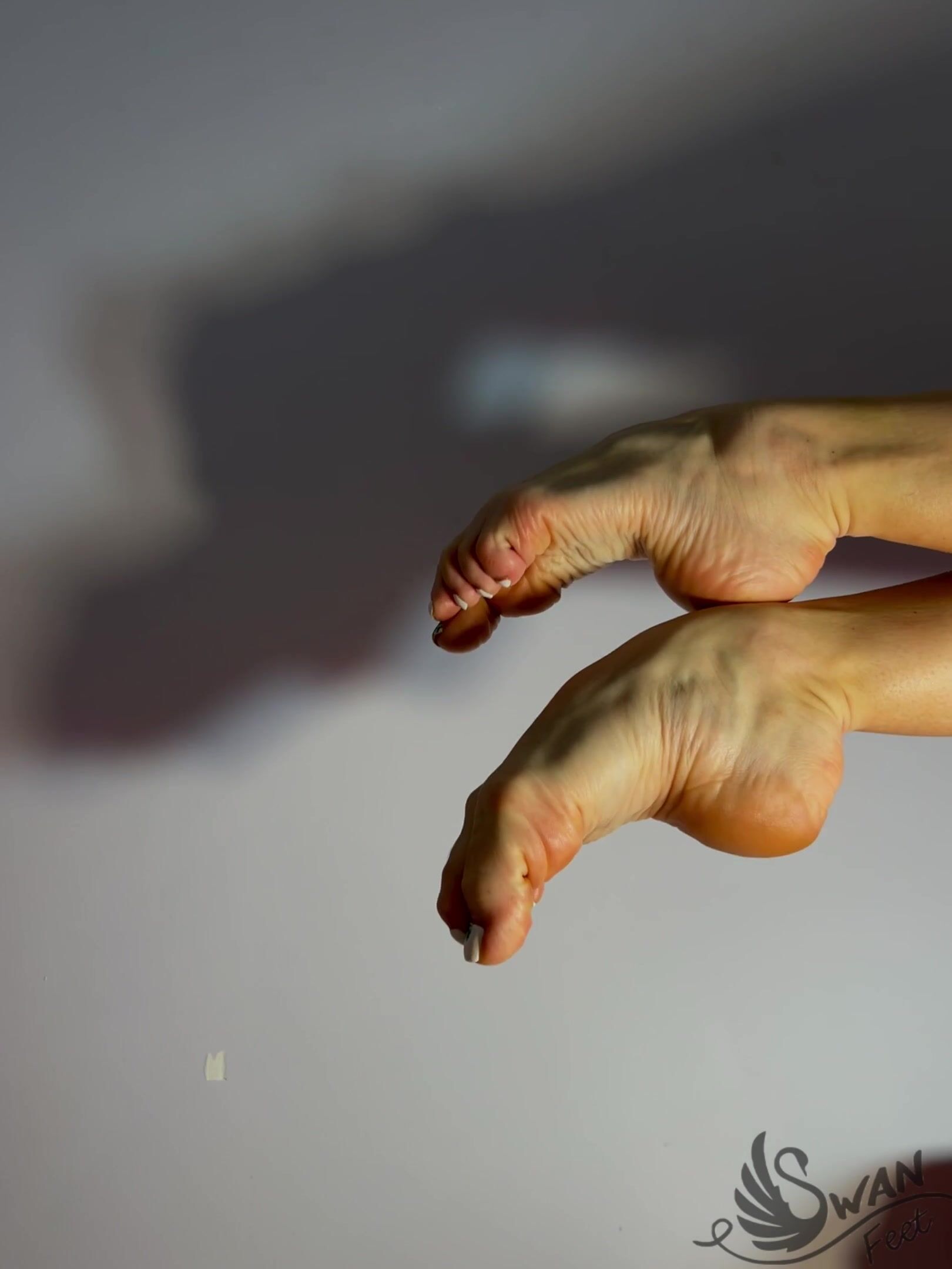 High Arched Feet 2