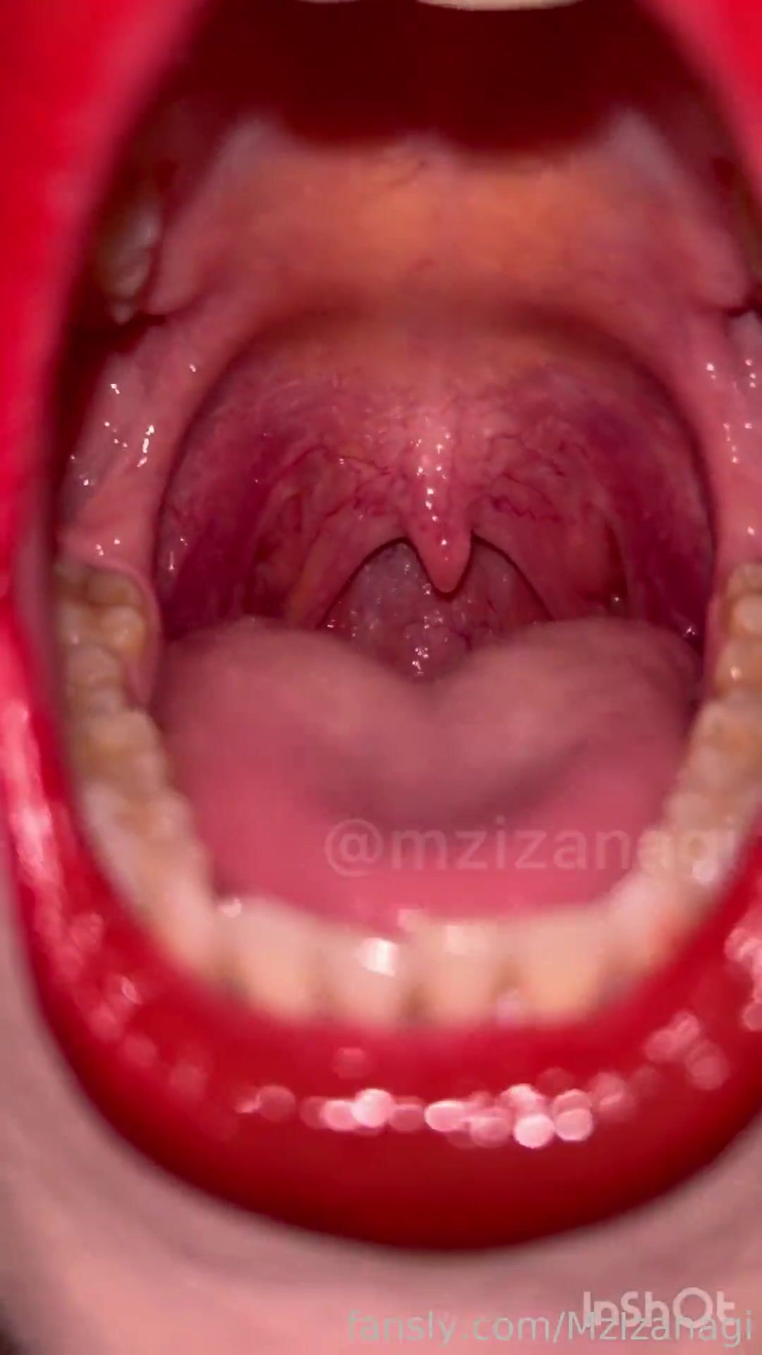 Mzizanagi mouth upclose uvula