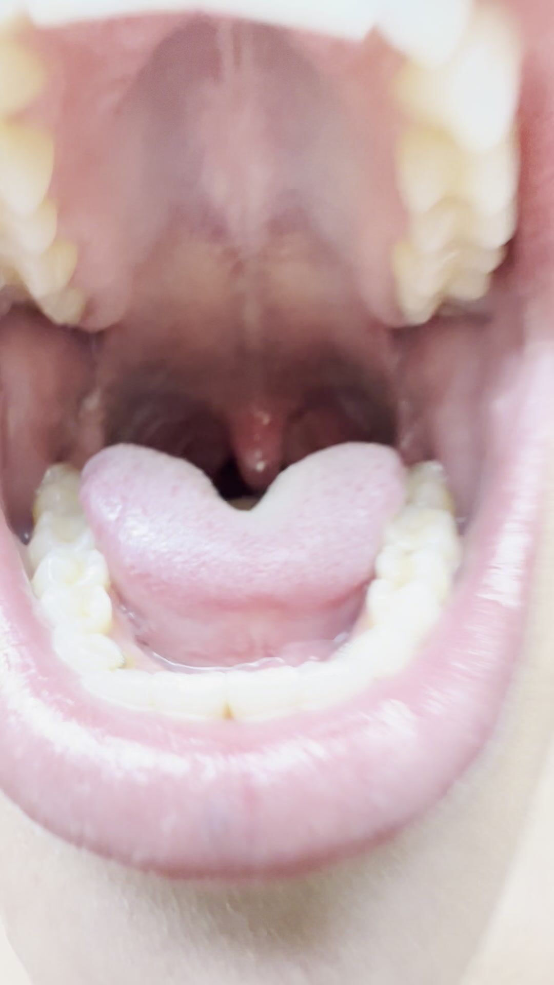 GK Vore swallow
