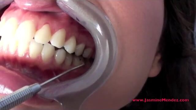 Jasmin Mendez dental mouth tour