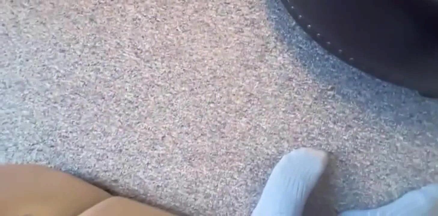 Eden A very Hands on Patient