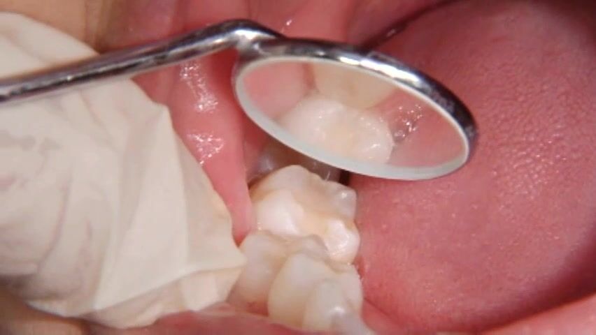 おのうえ わかば mouth exam