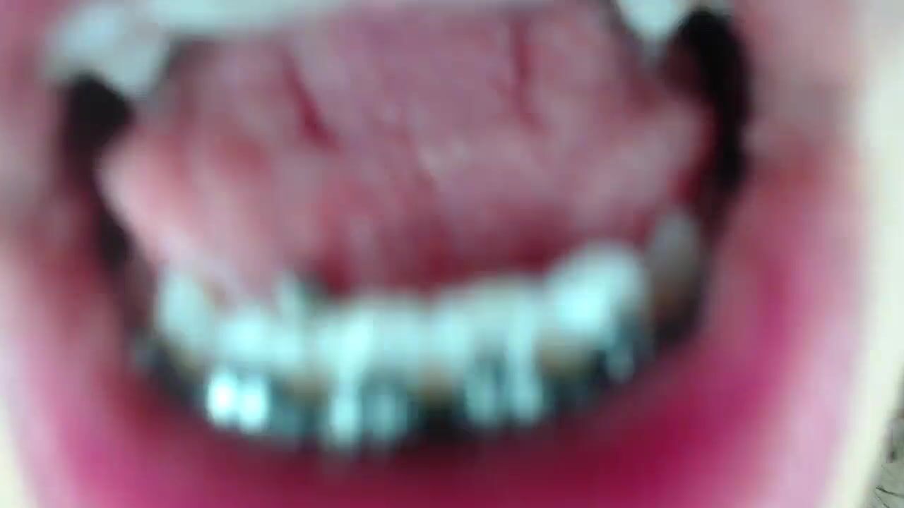 luciana3c - mouthtour with braces - ManyVids