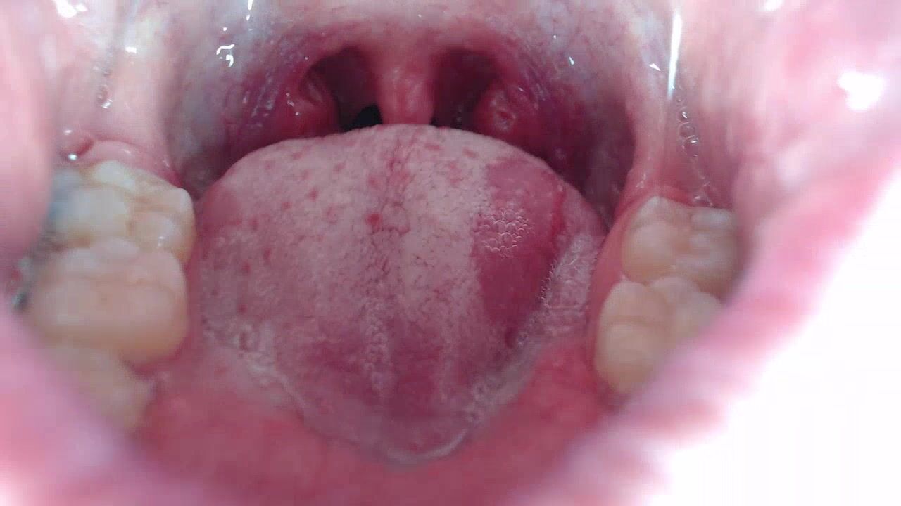 luciana3c - Braces, mouth, uvula fetish